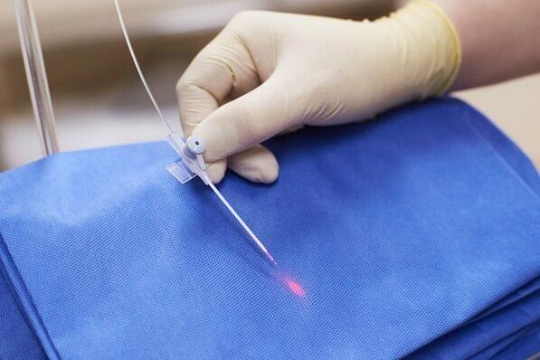 В някои случаи лазерната терапия се използва при хроничен простатит